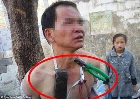 D&acirc;n l&agrave;ng bắt người đ&agrave;n &ocirc;ng đeo dụng cụ sử dụng để ăn trộm