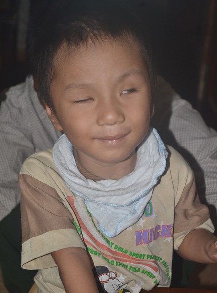 
3 tuổi nhưng Hữu Phương không biết nói, không biết đi, không nhìn được và suốt ngày quấy khóc.
