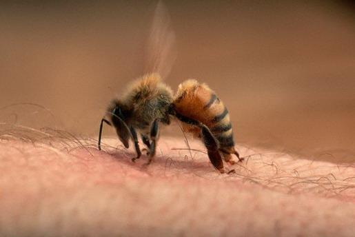 
Người lớn nếu bị hơn 10 nốt ong đốt đã rơi vào tình trạng nguy hiểm.
