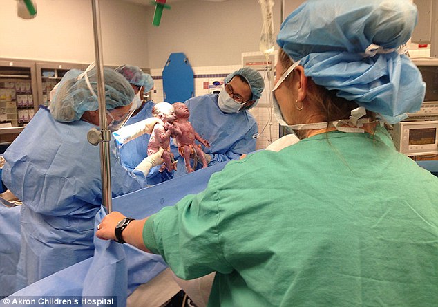 
Hai bé khi mới chào đời đã nắm chặt tay nhau.
