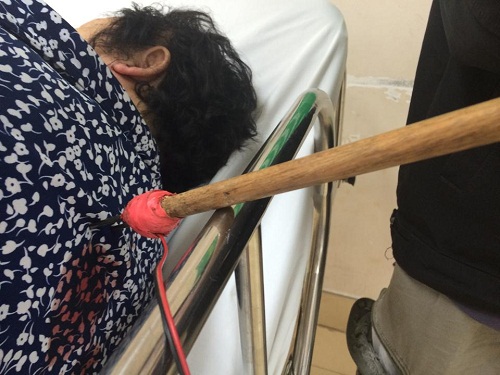 Nạn nh&acirc;n được đưa v&agrave;o viện với mũi t&ecirc;n c&ograve;n cắm v&agrave;o lưng (ảnh: CTV)