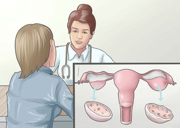 
Viêm buồng trứng nếu không được điều trị kịp thời có thể gây tắc ống dẫn trứng, khiến trứng và tinh trùng không thể gặp nhau và gây vô sinh. Ảnh minh họa
