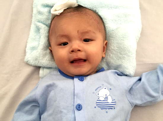 
B&eacute; Ph&aacute;t b&igrave;nh phục ngoạn mục sau lần mổ thứ 3. Ảnh:&nbsp;Thi&ecirc;n Chương
