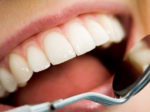 Cao răng là loại chất lắng cặn cứng của muối vô cơ gồm canxi carbonat và phosphate. 