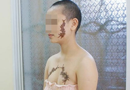 C&ocirc; g&aacute;i xứ Nghệ bị xăm h&igrave;nh con rết