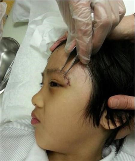 
Con trai tài tử Ngô Trấn Vũ bị tổn thương mắt vĩnh viễn sau tai nạn trên trường quay Bố ơi mình đi đâu thế mùa 2. Ảnh: QQ.
