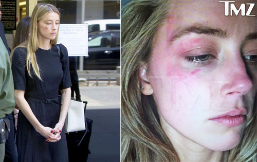 Amber Heard xuất hiện tại tòa chiều ngày 27/5 với gương mặt bầm tím.