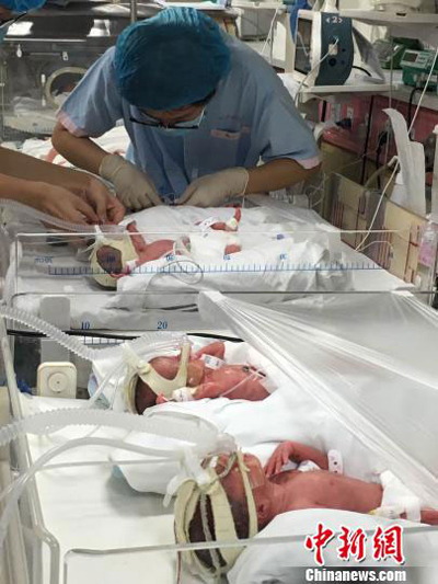 
Các y tá kiểm tra sức khỏe của các bé. Ảnh: China News
