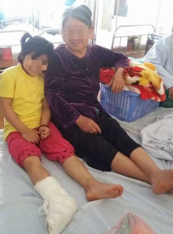 Cháu N đang nằm điều trị tại Khoa Ngoại, Bệnh viện Gang Thép Thái Nguyên.