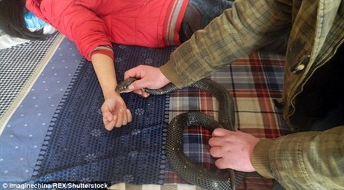 Con gái đã phải nhập viện vì trúng nọc độc của rắn hổ mang.