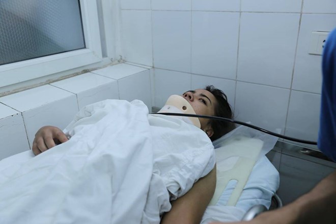 Bệnh nhân Nhung tại bệnh viện Việt Đức. Ảnh: Quang Đúc.