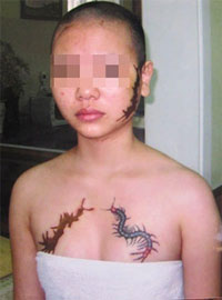 Nguyễn Thị Giang sau khi bị đ&aacute;nh ghen