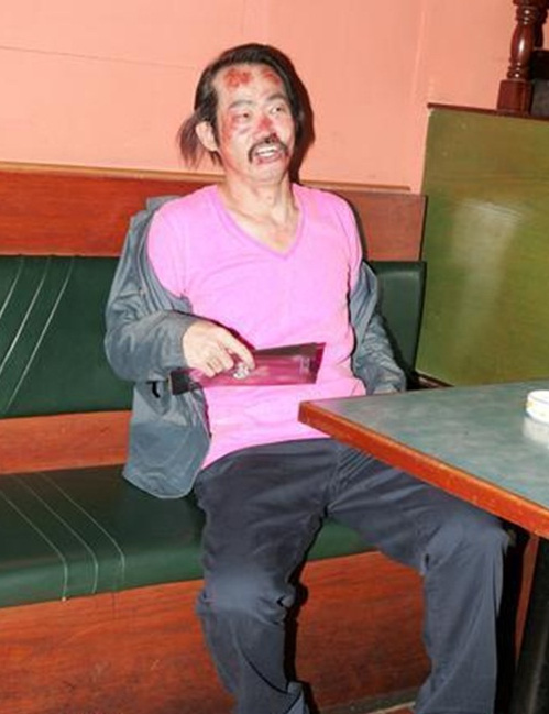 
Ở tuổi 62, Nguyên Hoa chật vật kiếm sống, bị thương với thù lao bèo bọt

