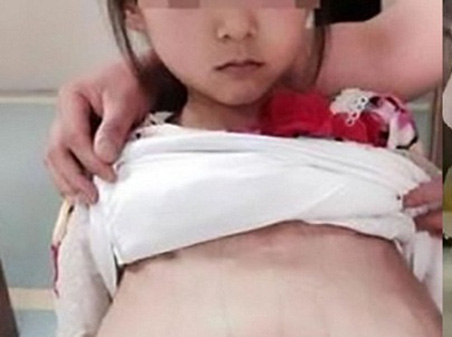 Cháu bé 12 tuổi đi khám thai tại Trung Quốc được cho là người Việt Nam. Ảnh tư liệu