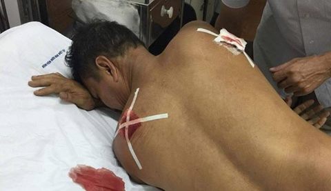 
Hình ảnh ông Đặng Văn Lưu đang nằm điều trị tại Bệnh viện.
