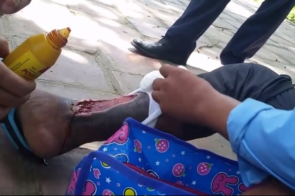 Nam thanh niên cố tình để lộ chiếc chân giả bị hoại tử để cầu xin sự giúp đỡ của mọi người (ảnh cắt từ clip do bạn đọc cung cấp).