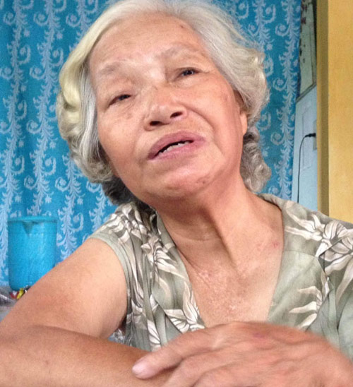 
B&agrave; Cam t&acirc;m sự về cuộc đời v&agrave; căn bệnh lạ m&agrave; m&igrave;nh đang mắc phải
