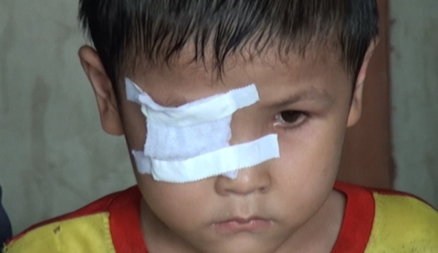 
Sau một thời gian dài chống chọi với căn bệnh ung thư mắt, giờ đây cậu bé Hoàng Ngọc Diễn đã không còn nhìn thấy ánh sáng. Ảnh: Khắc Điệp
