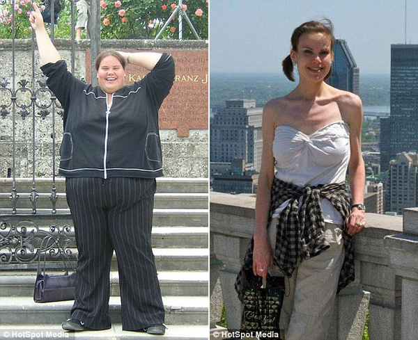 
Lisa lúc nặng nhất, 187kg (ảnh trái) và trong giai đoạn biếng ăn, cân nặng thấp nhất của cô chỉ là 49kg (cỡ 6).

