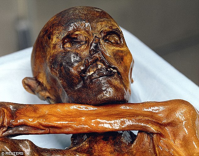 
Xác ướp “otzi” được phát hiện 25 năm trước.
