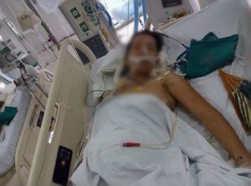 
Chi Nguyễn Thị Hường đang nằm cấp cứu trong tình trạng nguy kịch.
