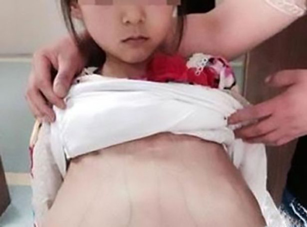 B&eacute; g&aacute;i đang c&oacute; thai được khoảng 3 th&aacute;ng. Ảnh: AsiaWire 