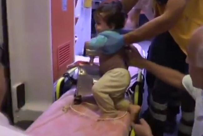 
Em b&eacute; đ&aacute;ng thương nhập viện trong t&igrave;nh trạng c&aacute;nh tay vẫn đang bị kẹt trong chiếc m&aacute;y xay thịt.
