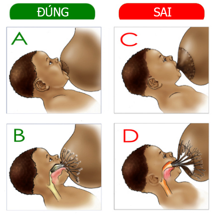 
Bú đúng cách là bé ngậm được quầng vú ở mức tối đa.
