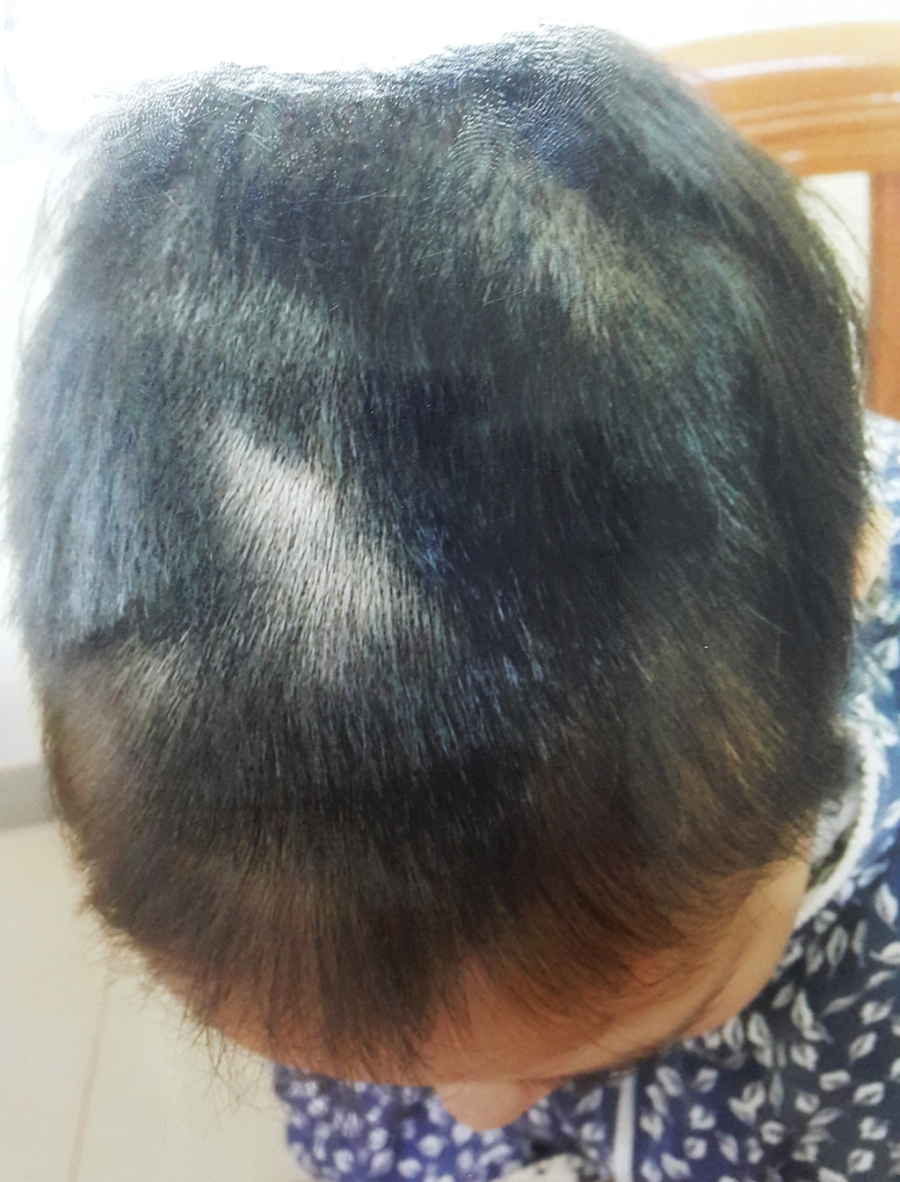 Mái tóc của P. bị cắt nham nhở nhưng rất may thai nhi không bị ảnh hưởng.
