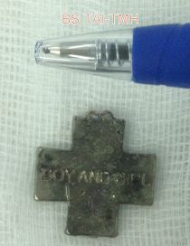 
Dị vật hình chữ thập được lấy ra từ thực quản bé
