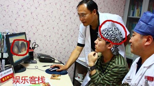 Hình ảnh khi Trí Siêu đến viện kiểm tra trước ca phẫu thuật vài năm trước. Có thể thấy vùng da đầu của anh bị tổn thương nặng. Ảnh: Baidu.