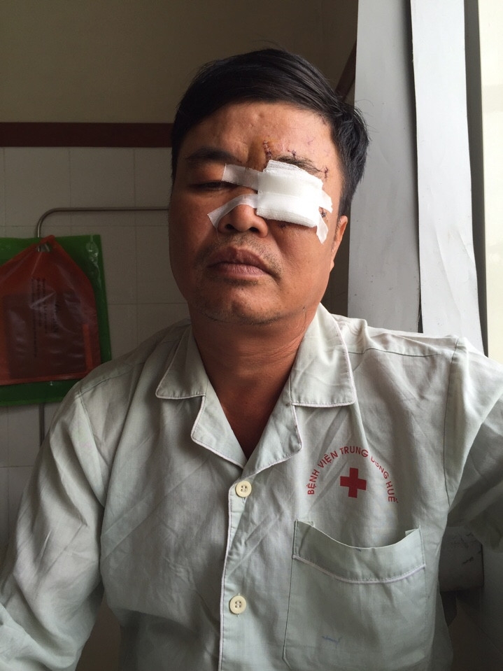 Nạn nhân Hoàng Đắc Phường
