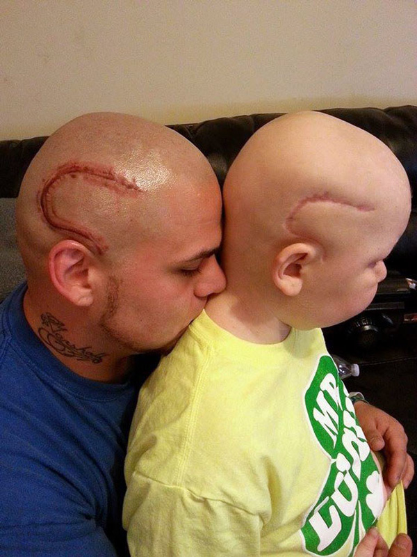 
Josh đã xăm hình vết sẹo giống con trai để động viên tinh thần cậu bé (Ảnh: Internet)
