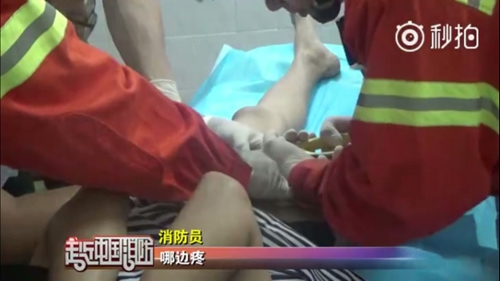 
90 ph&uacute;t sau chiếc nhẫn mới được cắt bỏ.
