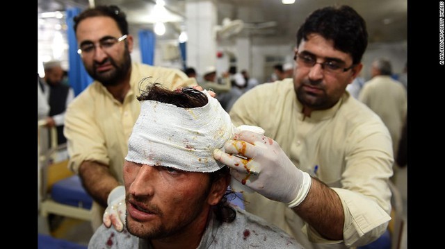 
Người đàn ông đang được điều trị trong bệnh viện ở Peshawar
