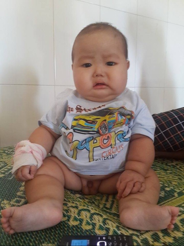 
Bé trai 9 tháng tuổi Hoàng Văn Thắng mang trong mình căn bệnh thận hư bẩm sinh (cháu bị phù nề nặng)
