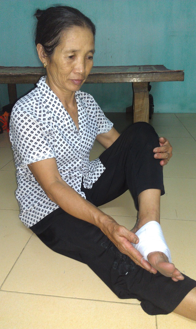 Bà Chu Thị Liên (61 tuổi, xã An Khánh, huyện Hoài Đức, Hà Nội) đã áp dụng bài thuốc này từ năm 2013.