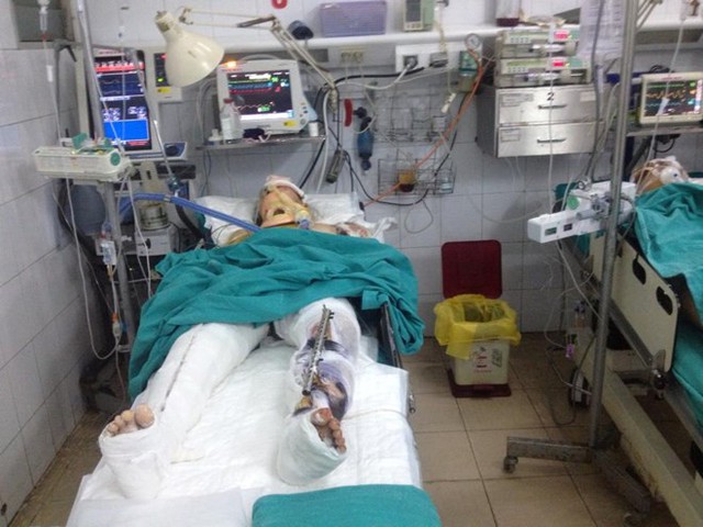 
Bệnh nhân Bình đã được mổ cấp cứu, cắt tay trái và đang trong tình trạng hôn mê. Ảnh: Facebook
