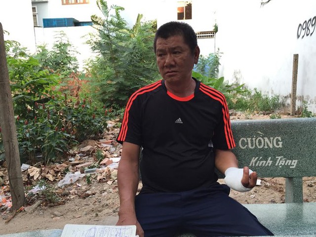 Ông Văn Quốc Thuận bị chém đứt 2 ngón tay. Ành: Lê Trai