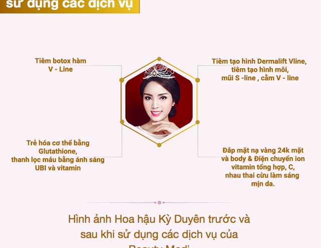 
Những dịch vụ Kỳ Duyên sử dụng.
