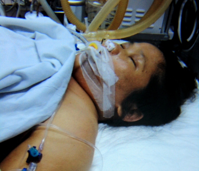 Bệnh nhân Trần Thị Là khi đang điều trị tại BV Đà Nẵng.