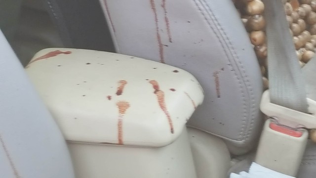 Vết máu trong xe taxi. Ảnh: Đức Hoàng