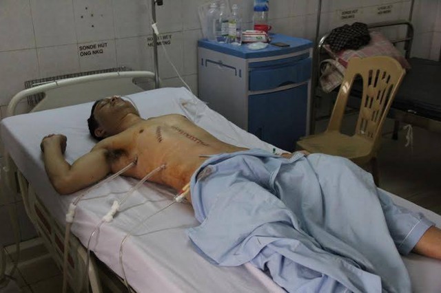 
Phó Công an xã Thanh Thủy, ông Đỗ Thế Quỳnh đang cấp cứu tại bệnh viện.
