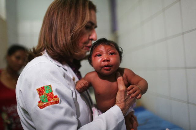 Không phải trường hợp thai phụ nhiễm virus Zika nào cũng gây hội chứng đầu nhỏ trẻ sơ sinh. Ảnh: TL