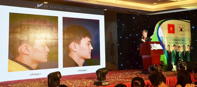 Những hình ảnh trước sau trong phần trình bày của TS. BS. Man Koon Suh - Viện trưởng Bệnh viện thẩm mỹ JW Hàn Quốc toàn cầu - về chủ đề Phẫu thuật mũi ngắn hếch thu hút nhiều sự quan tâm của khách hàng