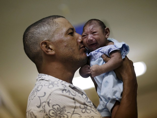 
Không phải trường hợp thai phụ mắc virus Zika, thai nhi đều mắc hội chứng đầu nhỏ. Ảnh: TL
