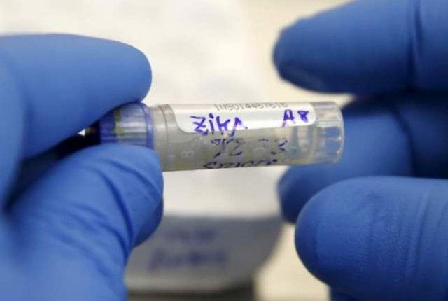 Bộ kit xét nghiệm virus Zika cho kết quả trong vòng 40 phút và giá sản xuất chỉ 2 USD/bộ đang được các nhà nghiên cứu tại Hoa Kỳ phát triển.