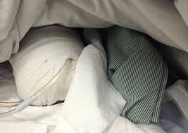 Ti&ecirc;n lượng r&acirc;́t x&acirc;́u cho tình trạng b&ecirc;̣nh nh&acirc;n bị cắt ch&acirc;n 2