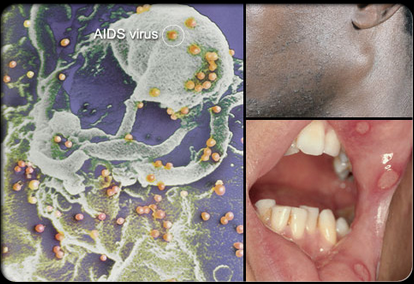 Sởn da g&agrave; những h&igrave;nh ảnh bệnh l&acirc;y qua đường t&igrave;nh dục 9