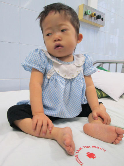 Số phận nghiệt ngã của bé 3 tuổi từng bị bỏ rơi tím tái  3